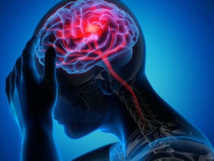 Diqqətlə oxu və özündə insult baş verməsinin qarşısını al!