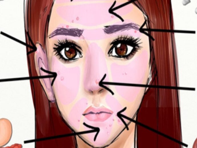 Alında çıxan sızanaq nədən xəbər verir? Bəs yanaqda? — Xəstəliyini özün müəyyən et