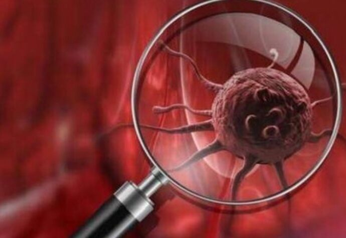 Xərçəng belə yaranırmış – BU QİDALARDAN UZAQ DURUN / VİDEO