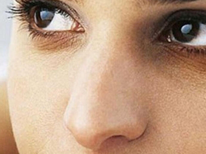 Gözaltı qaralmaların SƏBƏBİ NƏDİR?